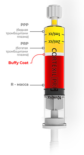 BUFFY COAT
